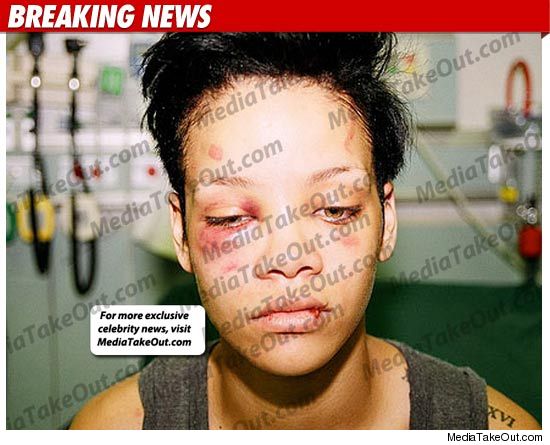 rihanna beaten by chris brown pictures. Brown assaulted Rihanna in