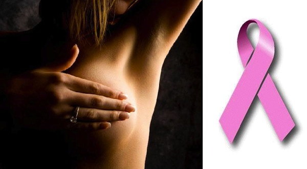 breast_cancer1