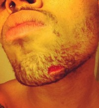 Chris Brown and Drake Fight In New York Club : Chris Brown Bloody Face (PHOTOS)